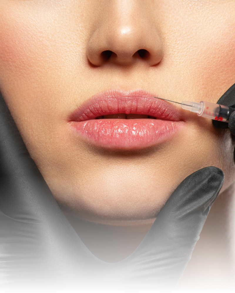 Labios
