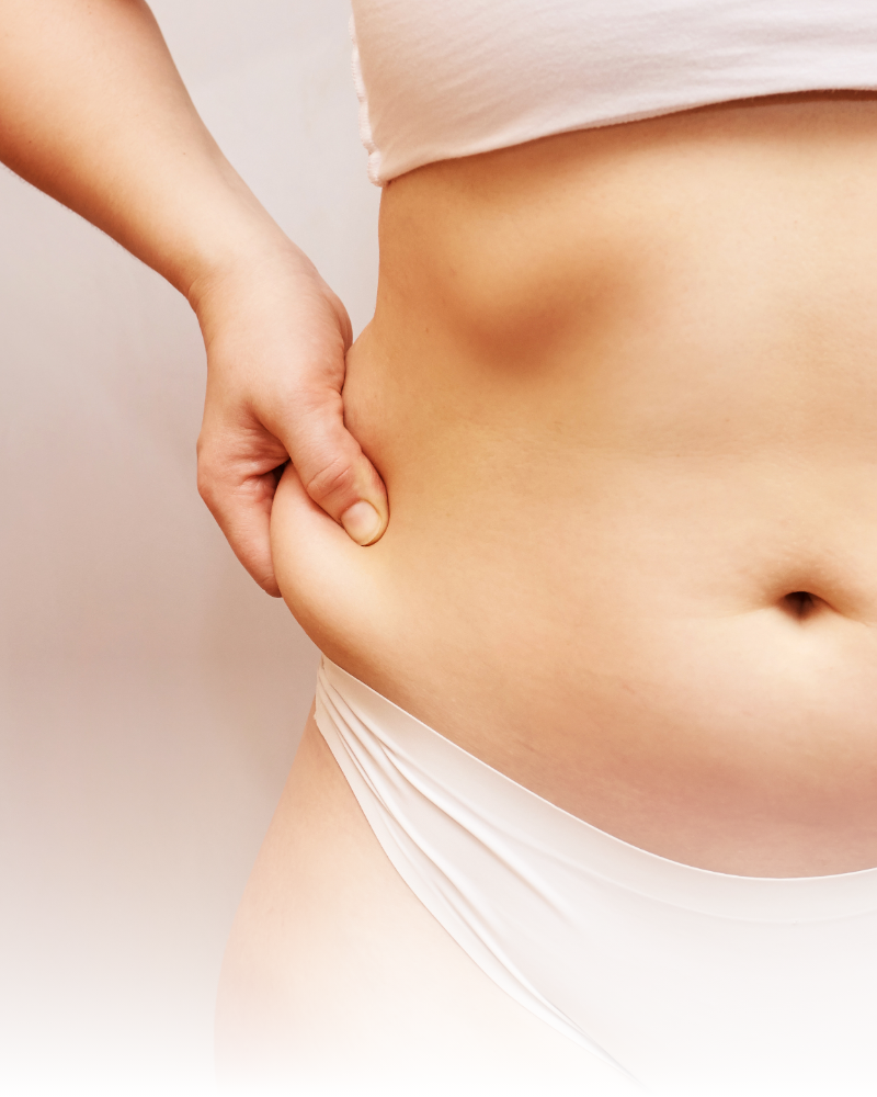 Grasa Localizada (Abdomen, Flancos, Cartucheras, Glúteos, Muslos)