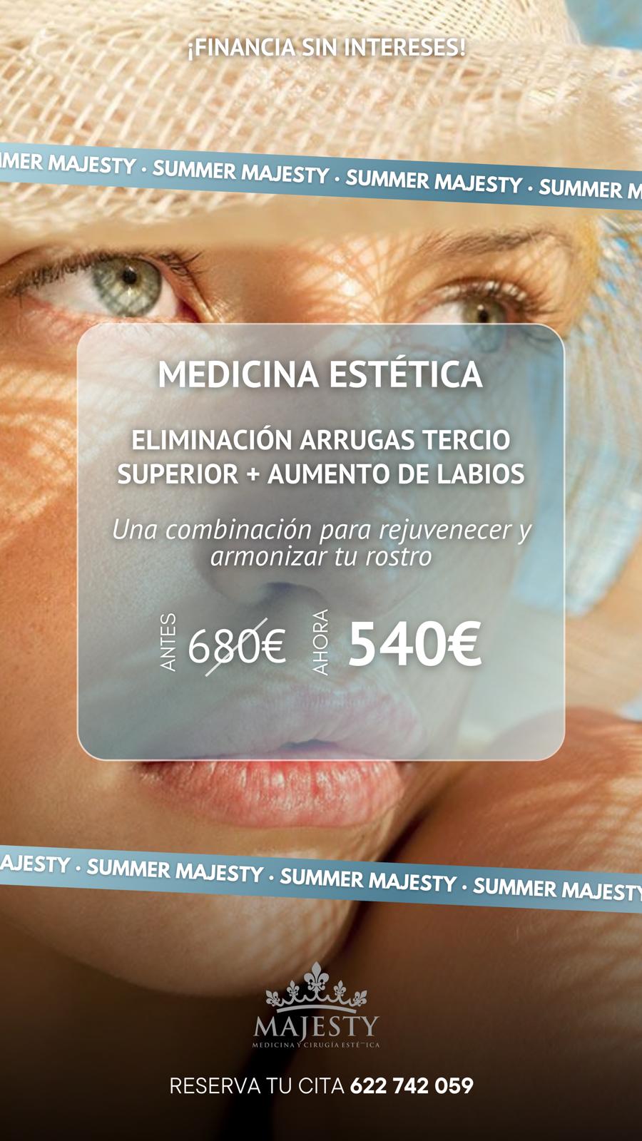 Eliminación Arugas Tercio Superior + Aumento de Labios
