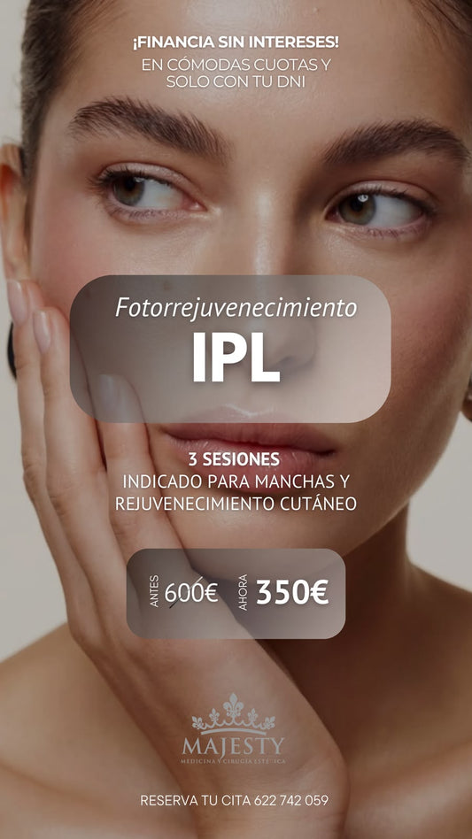 Fotorrejuvenecimiento IPL