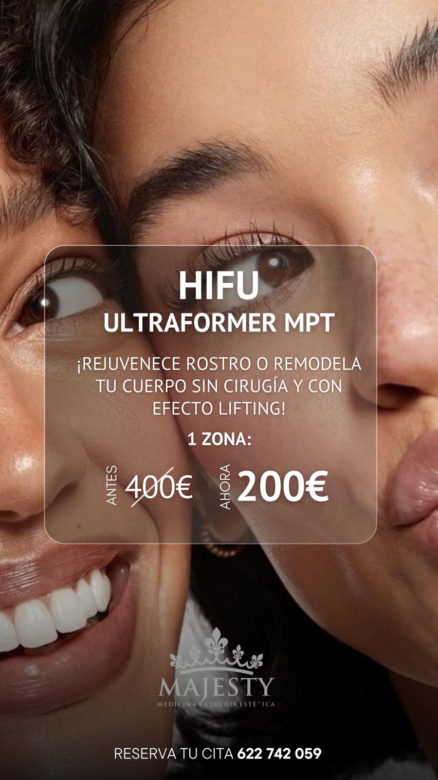 HIFU | Ultraformer MPT